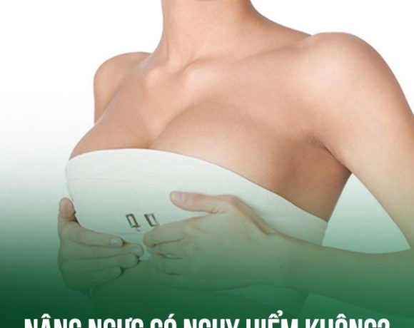 Nâng ngực có nguy hiểm không? Có nên nâng ngực không? 